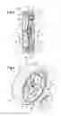 Fig. 03 - Wheel forming an improved agricultural tool