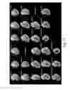 Fig. 35 - Hematopoietic stem cell specific reporter mouse and uses thereof