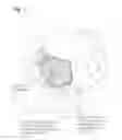 Fig. 02 - Hat for securing external hardware of a cochlear implant