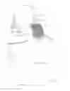 Fig. 02 - DEVICE TO PREVENT BRAIN DAMAGE FROM A SEVERE IMPACT TO AN ATHLETE'S HEAD