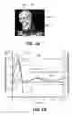 Fig. 02 - SYSTEM FOR REDIRECTING HEAD IMPACT FORCE