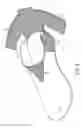 Fig. 10 - Fast transition running shoe