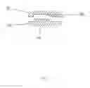 Fig. 06 - Method and Device for Addressing Leg Length Inequality