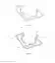 Fig. 13 - FATIGUE REDUCTION DEVICE