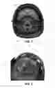 Fig. 02 - Closure devices for seat cushions