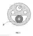 Fig. 04 - Catheter using optical fiber and camera