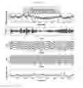 Fig. 07 - System and method for assessing treatment effects on obstructive sleep apnea
