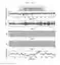 Fig. 08 - System and method for assessing treatment effects on obstructive sleep apnea