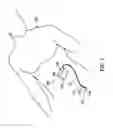 Fig. 02 - Devices and methods for sensing physiological signals during stimulation therapy