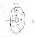 Fig. 07 - System and method for assessing dimensions and eccentricity of valve annulus for trans-catheter valve implantation