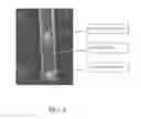 Fig. 06 - Service-Detectable Analyte Sensors and Methods of Using and Making Same
