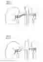 Fig. 02 - Method and device for determining a damage characteristic value of a kidney