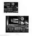 Fig. 02 - METHOD FOR DIAGNOSING OSTEOPOROSIS BY A METHOD FOR DEFINING THE DYNAMICS OF CLOSING CAVITY FORMATIONS IN ORDER TO ASSESS THE EFFECTIVENESS OF USING VARIOUS OSTEOPROTECTORS