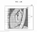 Fig. 23 - Tomography apparatus and method of displaying tomography image by tomography apparatus