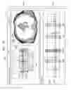 Fig. 32 - Tomography apparatus and method of displaying tomography image by tomography apparatus