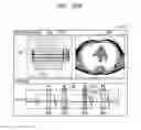 Fig. 37 - Tomography apparatus and method of displaying tomography image by tomography apparatus
