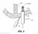 Fig. 09 - Closing openings in anatomical tissue