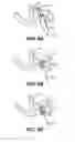 Fig. 10 - Closing openings in anatomical tissue