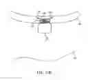 Fig. 45 - SYSTEM AND METHOD FOR TRANSAPICAL ACCESS AND CLOSURE