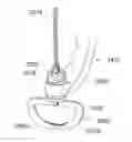 Fig. 01 - Medical kit for constricting tissue or a bodily orifice, for example, a mitral valve