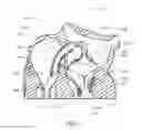 Fig. 03 - Medical kit for constricting tissue or a bodily orifice, for example, a mitral valve
