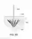 Fig. 08 - Medical kit for constricting tissue or a bodily orifice, for example, a mitral valve