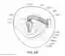 Fig. 40 - Medical kit for constricting tissue or a bodily orifice, for example, a mitral valve