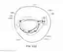 Fig. 55 - Medical kit for constricting tissue or a bodily orifice, for example, a mitral valve