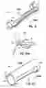 Fig. 09 - Apparatus and methods for occluding a hollow anatomical structure