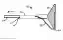 Fig. 01 - Methods and Systems for Capturing and Removing Urinary Stones from Body Cavities