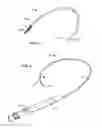 Fig. 02 - Methods and Systems for Capturing and Removing Urinary Stones from Body Cavities