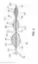 Fig. 08 - Devices and methods for vascular recanalization