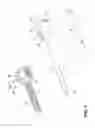Fig. 02 - TROCAR SEAL ASSEMBLY