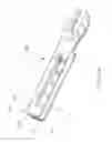 Fig. 08 - Ulna Osteotomy System