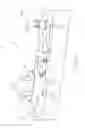 Fig. 09 - Ulna Osteotomy System