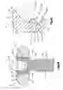 Fig. 08 - Bone fixation system