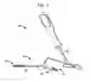 Fig. 02 - Intramedullary fixation assembly and method of use