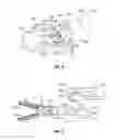 Fig. 04 - Surgical instrument with a separable coaxial joint