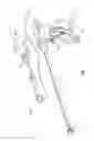Fig. 02 - SURGICAL INSTRUMENTS WITH REMOVABLE COMPONENTS