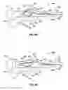 Fig. 07 - Blade deployment mechanisms for surgical forceps