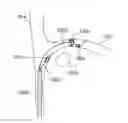 Fig. 01 - METHODS AND SYSTEMS FOR TREATING NERVE STRUCTURES
