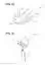 Fig. 22 - Patient specific implant technology