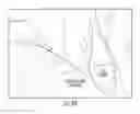 Fig. 43 - Method and system for transcranial photoacoustic imaging for guiding skull base surgeries
