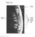 Fig. 07 - Medical Procedure Localizing Aid