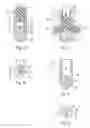 Fig. 02 - Medical device, apparatus, and surgical method
