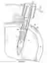 Fig. 09 - Method for soft tissue repair with free floating suture locking member