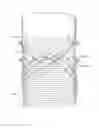 Fig. 07 - Methods and apparatus for endovascularly replacing a patient's heart valve