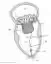 Fig. 01 - Adjustable tether and epicardial pad system for prosthetic heart valve