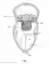 Fig. 02 - Adjustable tether and epicardial pad system for prosthetic heart valve