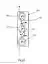Fig. 06 - Adjustable tether and epicardial pad system for prosthetic heart valve